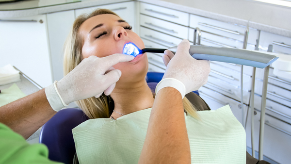 Restorations    : What To Expect During Dental Filling Treatment